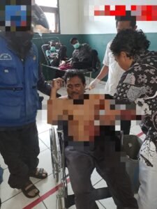 Aksi Brutal OTK di Puncak Jaya: Warga Luka Parah, Motor dan Penumpang Dirampas